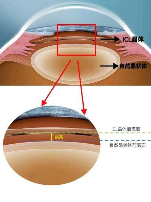 辽宁沈阳零度眼科医生团队实力强大及骨干医生简介