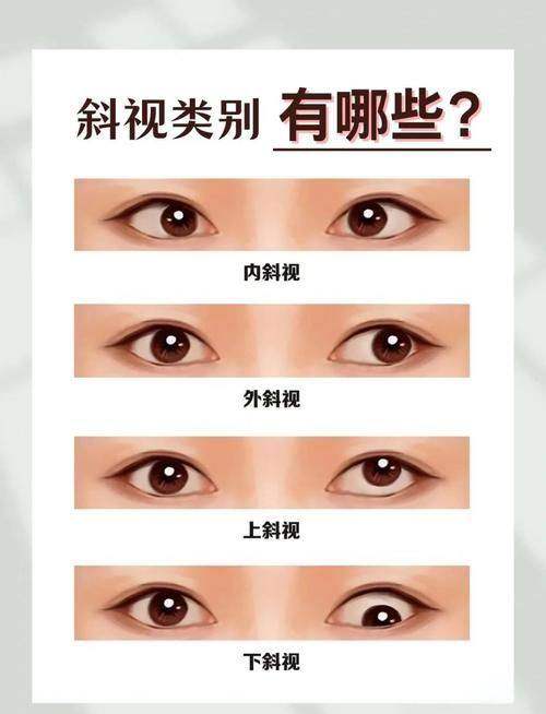 辽宁沈阳零度眼科地址电话营业时间