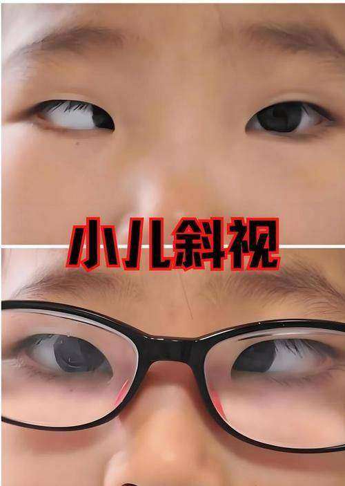 通用环球中铁西安医院眼科