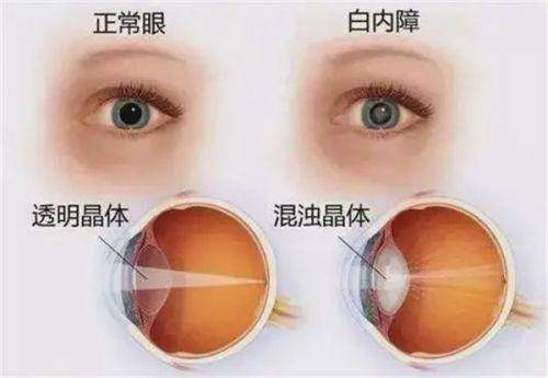 大连旅顺口爱尔眼视光诊所地址电话营业时间