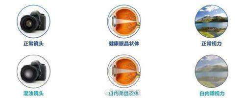 大连旅顺口爱尔眼视光诊所真人口碑评价怎么样？