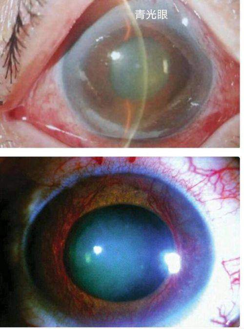 南京大学医学校附属金陵医院眼科详细的预约挂号方式及流程
