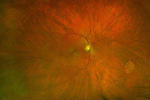 大连旅顺口爱尔眼视光诊所详细的预约挂号方式及流程