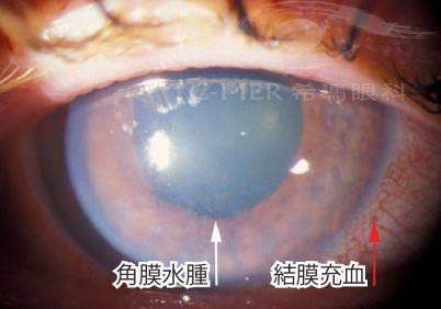 南京大学医学校附属金陵医院眼科特色项目及技术优势