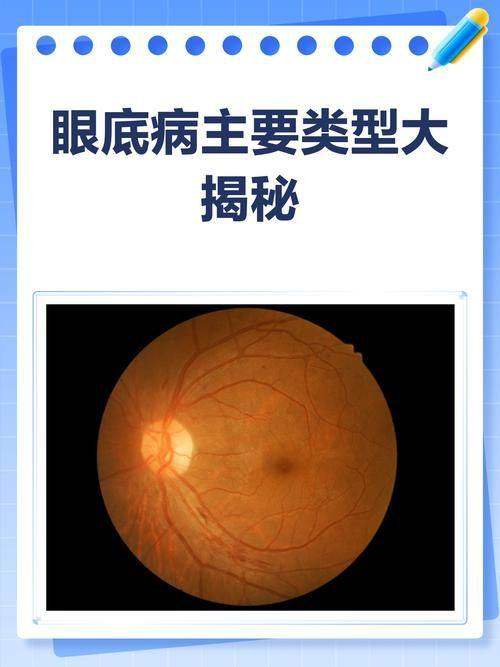南京大学医学校附属金陵医院眼科医生团队实力强大及骨干医生简介