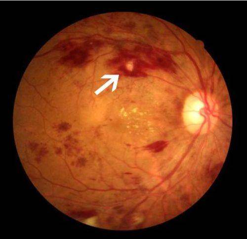 南京大学医学校附属金陵医院眼科收费价格表/收费标准