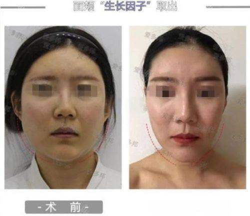 彭一纯医生坐诊医院