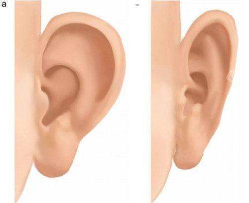 张小敏医生技术优势