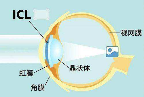 袁州爱瞳眼科门诊部是正规医院吗？