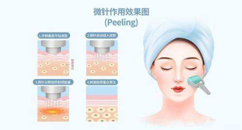 技术优势