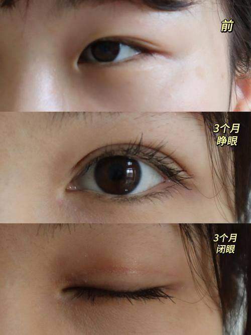 宁波海曙壹秒医疗美容诊所地址电话营业时间