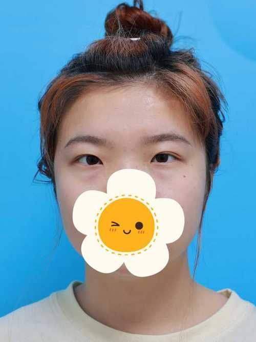 南昌大学整形医院真人口碑评价怎么样？