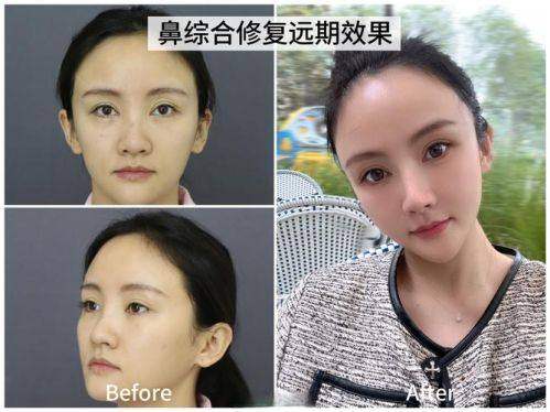 宁波海曙壹秒医疗美容诊所是正规医院吗？