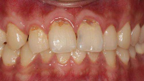 浙江宁波蓝野口腔门诊部特色项目及技术优势