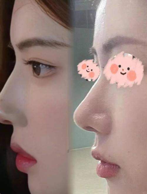 长沙谢磊天一医疗美容诊所是正规医院吗？