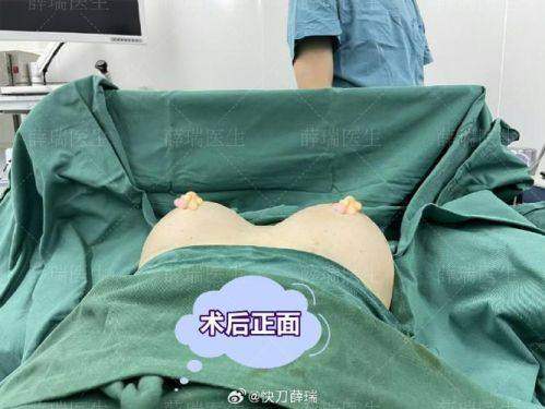 南昌大学整形医院收费价格表/收费标准