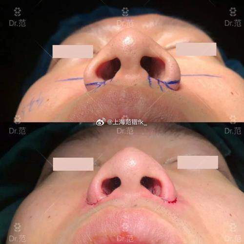 宁波海曙壹秒医疗美容诊所详细的预约挂号方式及流程