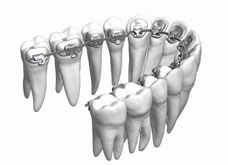 浙江宁波蓝野口腔门诊部是正规医院吗？