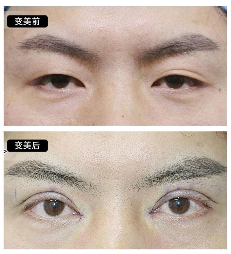 彭一纯医生价格表