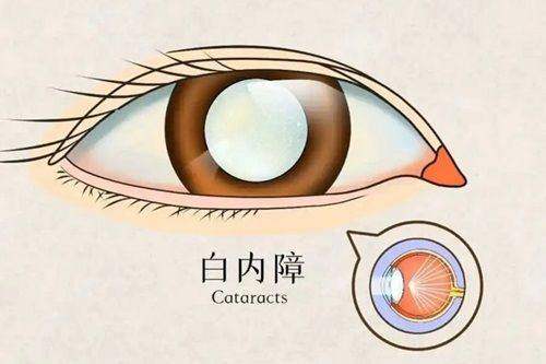广西医科大学第一附属医院眼科真人口碑评价怎么样？