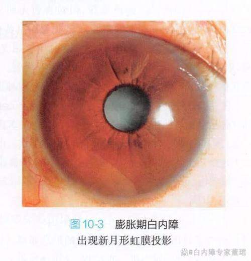 北京空军特色医学中 心眼科真人口碑评价怎么样？