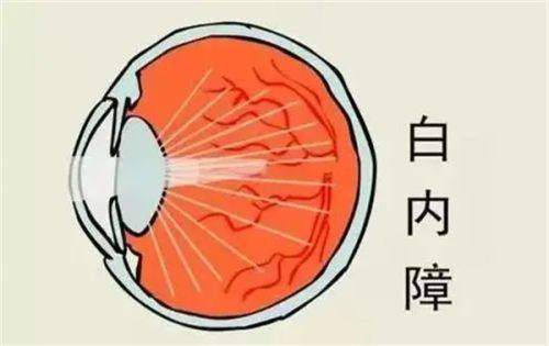 湖北荆州洛基眼科是正规医院吗？