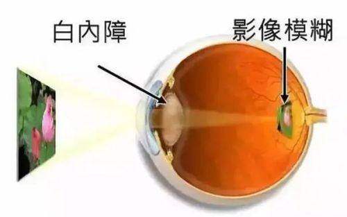 湖北荆州洛基眼科特色项目及技术优势