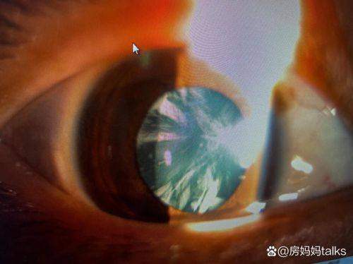 湖北荆州洛基眼科收费价格表/收费标准