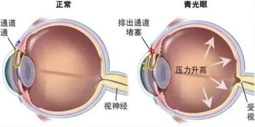 南昌大学附属眼科医院眼整形科真人口碑评价怎么样?