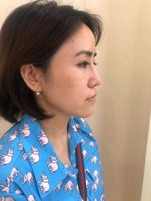 泰国圣卡洛整形医院真人口碑评价怎么样?