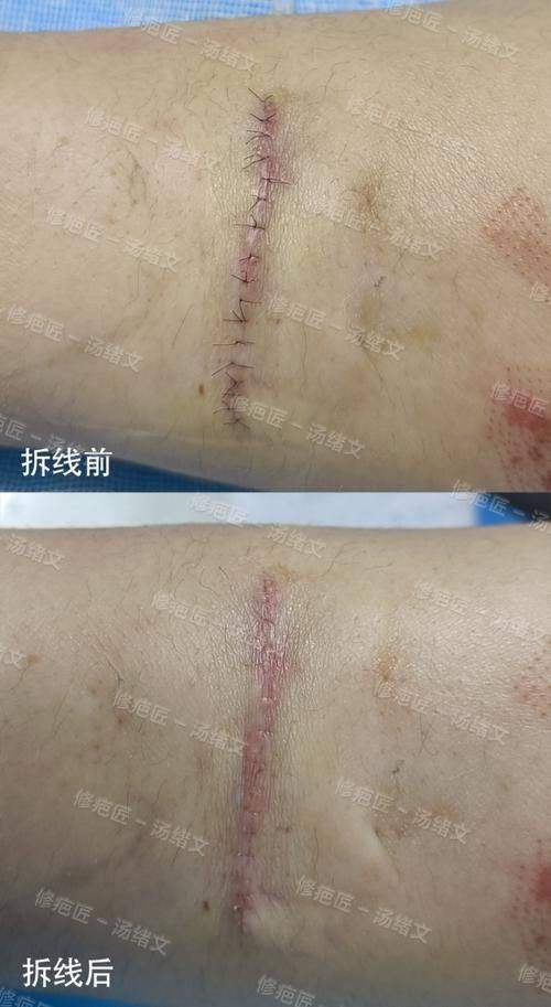 南昌大学附属眼科医院眼整形科特色项目及技术优势
