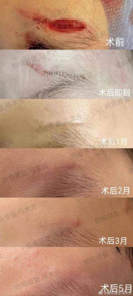 南昌大学附属眼科医院眼整形科地址电话营业时间