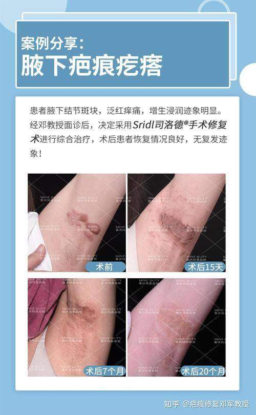 南昌大学附属眼科医院眼整形科详细的预约挂号方式及流程