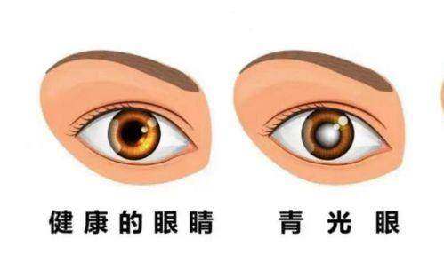 沈阳市第五人民医院眼科