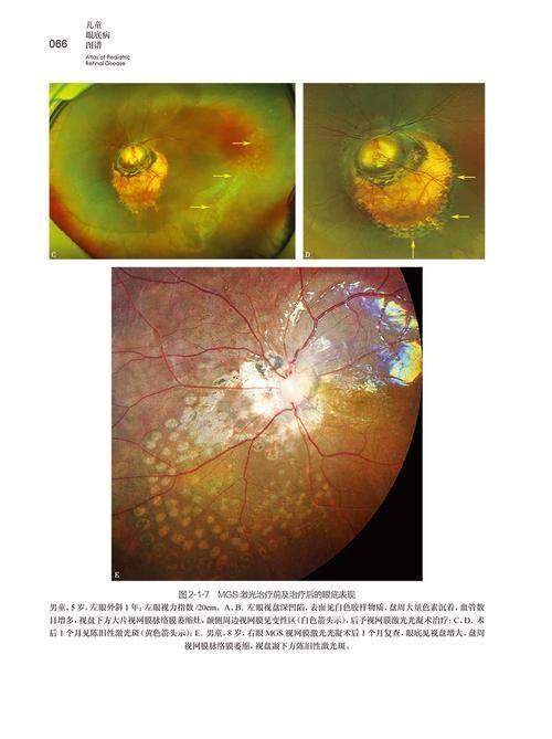 青岛新视界眼科医院整形科地址电话营业时间