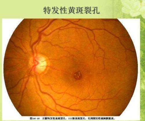 漳州华厦眼科医院详细的预约挂号方式及流程
