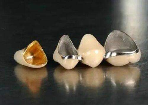 技术优势