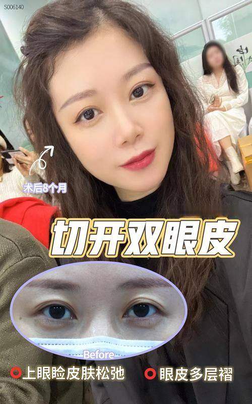 韩国傲婷美整形外科医院地址电话营业时间