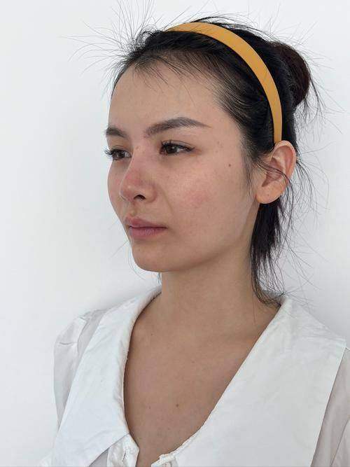 长沙伊百丽医疗美容医院特色项目及技术优势