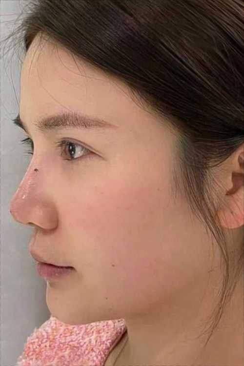 武汉欣悦医疗美容收费价格表/收费标准