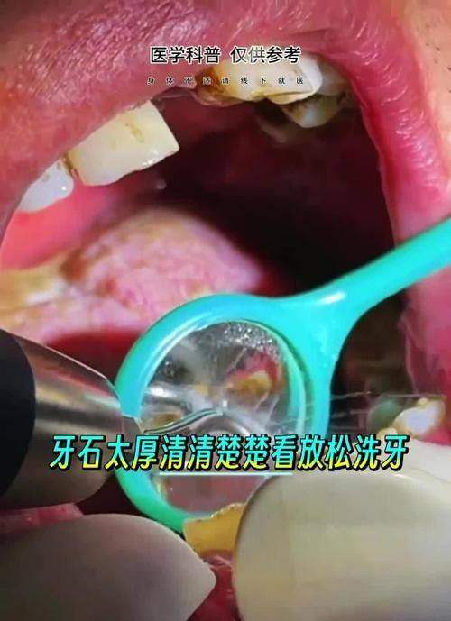 广州梁辉口腔门诊部地址电话营业时间