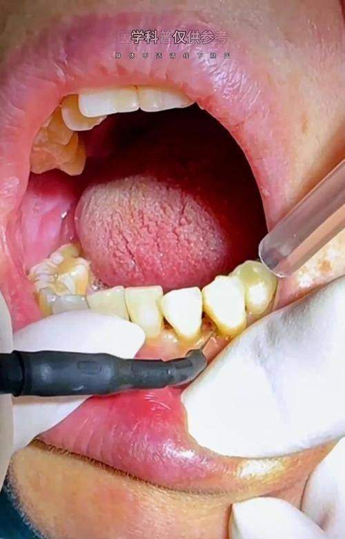 广州梁辉口腔门诊部真人口碑评价怎么样?