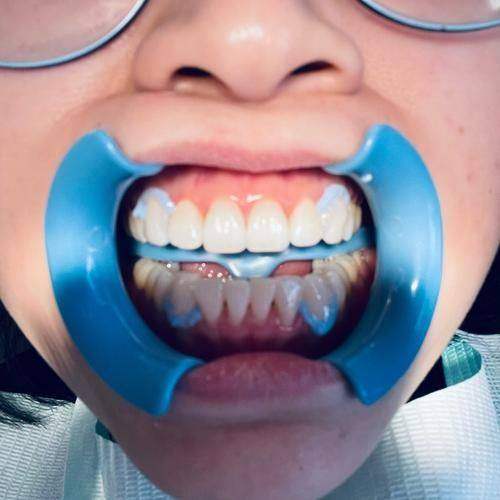 佛山爱雅口腔门诊部是正规医院吗？