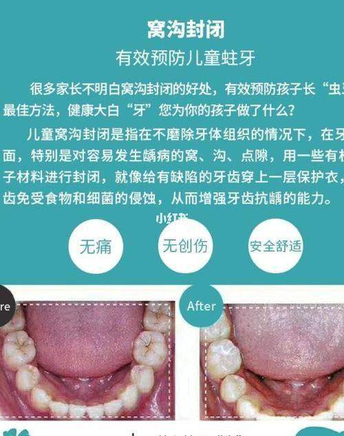 四川眉山吉美口腔特色项目及技术优势