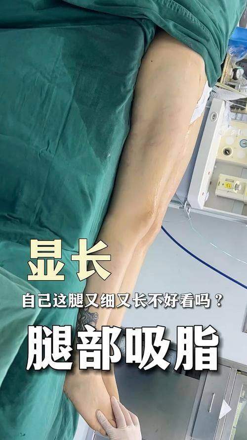 柳州市美嘉医疗美容详细的预约挂号方式及流程