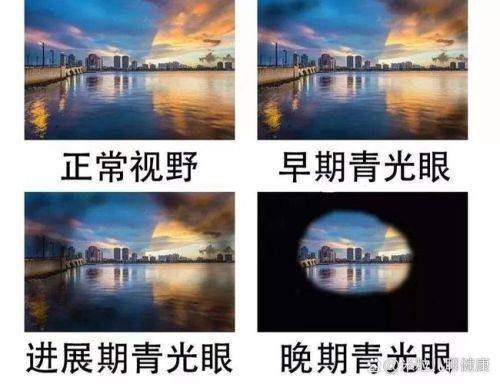长春市中医院眼科是正规医院吗？