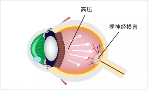 长春市中医院眼科详细的预约挂号方式及流程