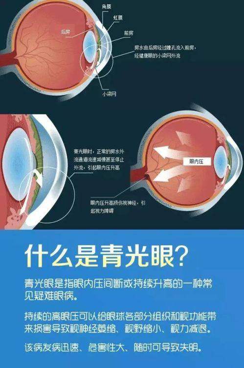 三门峡市眼科医院是正规医院吗？