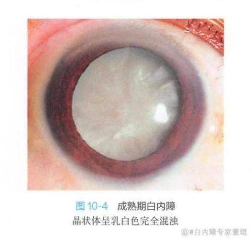 南通海门文慈眼科医院是正规医院吗？