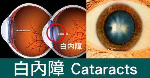 南通海门文慈眼科医院真人口碑评价怎么样？